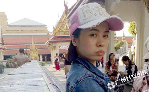 广州圣丹福医院护士林娟