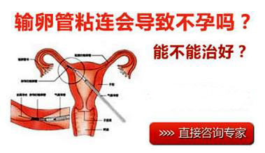 输卵管粘连有哪些常见症状