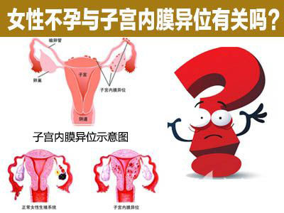 子宫内膜异位症有什么治疗方法