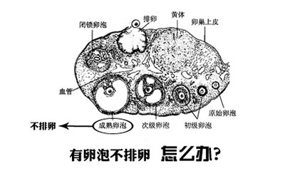 有卵泡不排卵该怎么办
