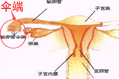 圣丹福输卵管伞端成形术 轻松打开生命孕育之门