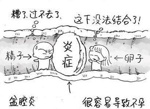 盆腔炎会导致不孕吗?