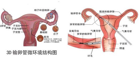 一条输卵管怀孕的几率