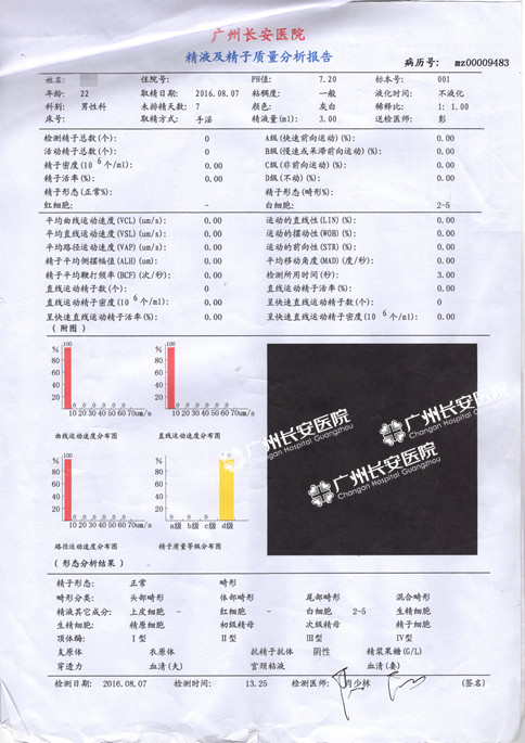 喜！22岁非梗阻性无精症患者睾丸首现“健康种子”